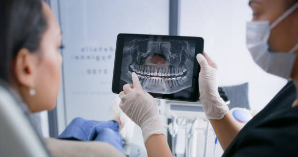 Licensed Dental Implants service in Moraga, CA - Smile Center Dentistry